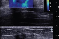 2016 08 04 13 43 54 419 Elastography 20160804204717