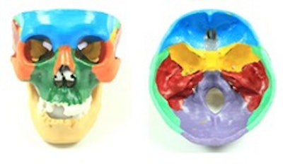 3D-printed skull. Image courtesy of Dr. Shi Chen.