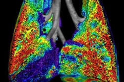 2016 08 17 13 54 43 948 2016 08 Fouras Preclinical Cf Ventilation 20160817205539