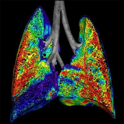 Preclinical image of cystic fibrosis shows ventilation in an animal model using a fluoroscopy acquisition. All images courtesy of Dr. Andreas Fouras and Dr Rajeev Samarage.