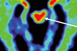 2016 08 22 16 00 22 555 Mri Cte Raji Aagp 20160822230142