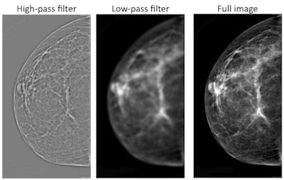 Images demonstrate mammograms with various levels of filtering, from high-pass image at left to unfiltered image at right. Courtesy of PNAS.