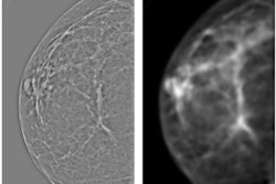 2016 08 29 15 54 08 25 Wolfe Filtered Images 400