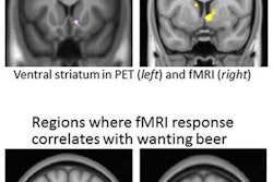 2016 08 31 13 19 34 287 Pet F Mri Beer Image 20160831202142