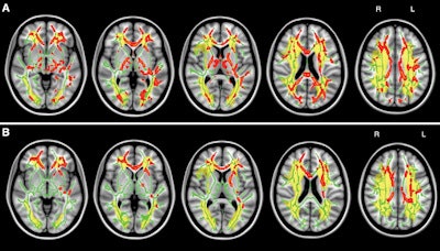 2016 09 06 16 13 50 944 Dti Brain Rad Meng 400