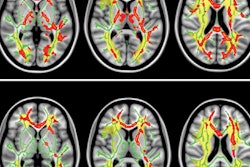 2016 09 06 16 13 55 699 Dti Brain Rad Meng 20160906231517