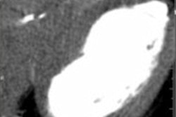 2016 09 07 09 25 59 234 2016 09 Albrecht Moritz Thumb