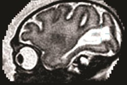 2016 09 12 15 49 22 959 Mri Zika Primate 20160912225141