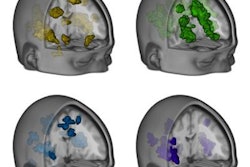 2016 09 14 17 07 52 548 F Mri Plos Biology 20160915000823