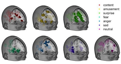 Colored regions indicate increased fMRI signal and brain regions associated with emotional states. Image courtesy of PLOS Biology.