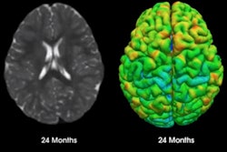 2016 09 19 10 35 59 3 Map Brain Study 400