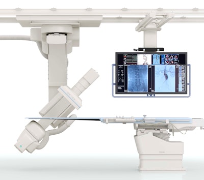 Toshiba's Infinix-i Sky+ angiography system.