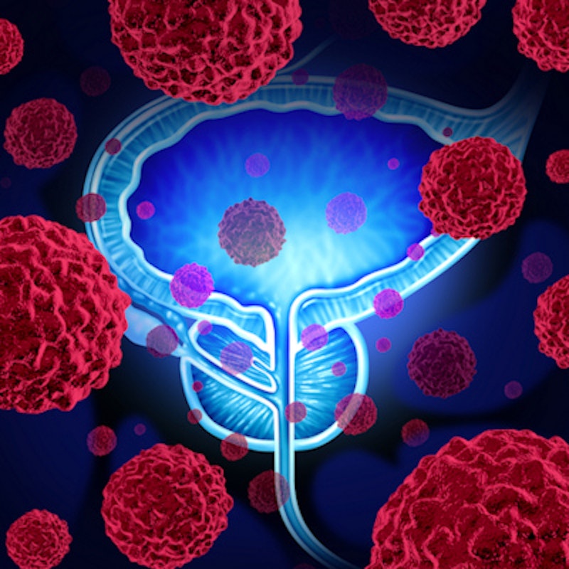 Abstinence before prostate MRI offers benefits in over 60s | AuntMinnie