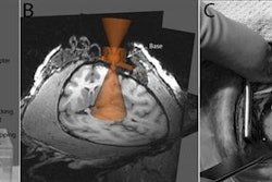 2016 10 12 15 05 03 231 Real Time Mri 20161012220534