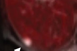 2016 10 13 16 02 59 837 2016 10 14 Petmri Breast 400