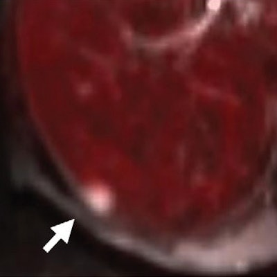 2016 10 13 16 02 59 837 2016 10 14 Petmri Breast 400