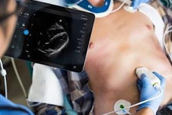 2016 10 14 09 32 47 413 Philips Lumify Transducer 20161014163502