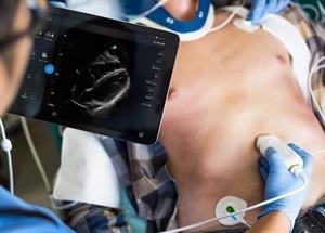 The Lumify S4-1 cardiac ultrasound transducer. Image courtesy of Philips Healthcare.