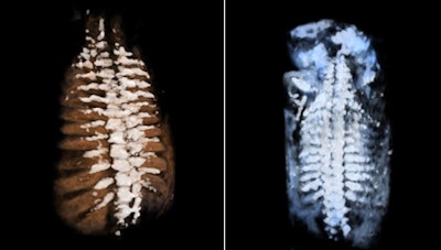 Fetal spine evaluated using skeletal view rendering with a sepia color map (left) and standard color map (right).