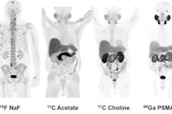 2016 10 24 15 02 21 408 Ga 68 Best Radiology Image 450