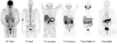2016 10 24 15 02 21 408 Ga 68 Best Radiology Image 450
