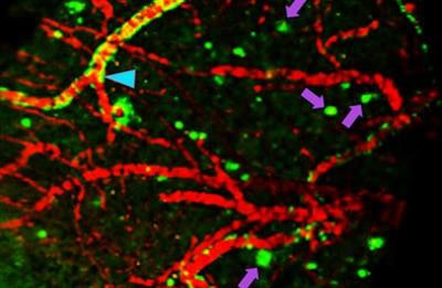 In the image above, fluselenamyl has passed from the bloodstream of a living mouse into its brain, where it is detected by a PET scan. Arrows indicate clumps of beta amyloid. Image credit: Ping Yan and Jin-Moo Lee.