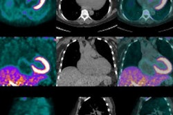 2016 11 03 10 49 44 854 Amyloidosis 400