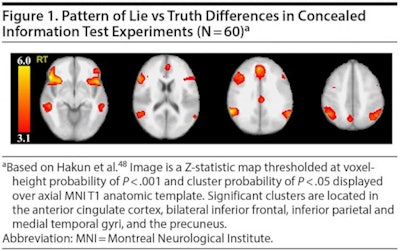 fMRI illustrates significant areas of brain activity in the anterior cingulate cortex, bilateral inferior frontal, inferior parietal and medial temporal gyri, and the precuneus, which were activated when someone was lying. Image courtesy of the University of Pennsylvania/Journal of Clinical Psychiatry.