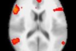 2016 11 04 15 05 33 149 F Mri Lie Detector 200