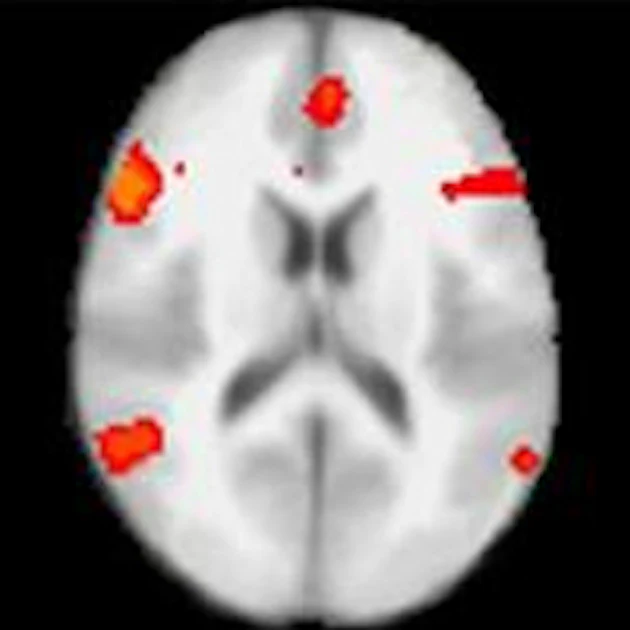 fMRI beats polygraph test in detecting lies | AuntMinnie