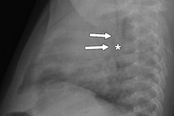 2016 11 07 14 49 19 252 Ajr Stanescu 2b 400