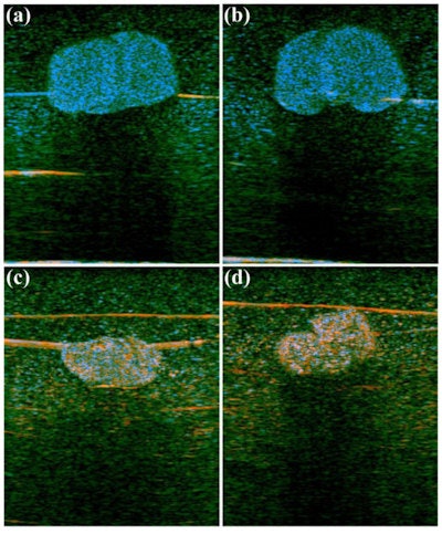 H-scan images showing an increase in fatty lipids in liver tissue (a and b) as well as a normal liver (c and d). The fat deposits in the liver are small scatterers and are shown accordingly as blue dots.
