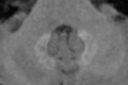 2016 11 16 12 01 34 773 Radbruch Gbca 400