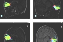 2016 11 21 14 56 41 768 Dti Music Rsna 400