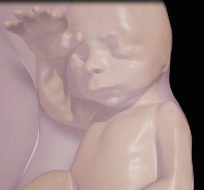 Above, close-up of fetus at 26 weeks. Below, visualization of internal structures at 27 weeks.
