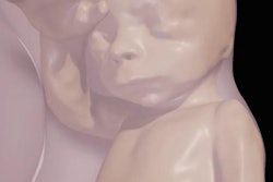 2016 11 21 17 32 57 152 2016 11 Fetal Vr 26weeks Thumb2 400