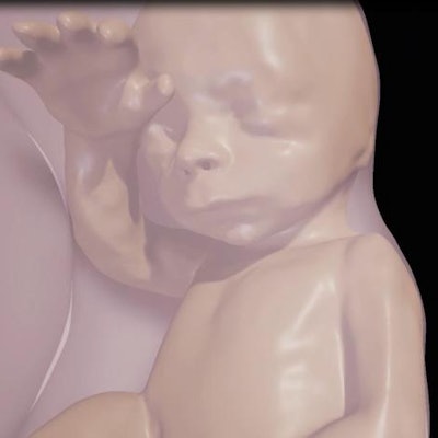 2016 11 21 17 32 57 152 2016 11 Fetal Vr 26weeks Thumb2 400