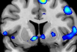 2016 11 23 17 54 42 461 F Mri Finds God Anderson 20161124005646