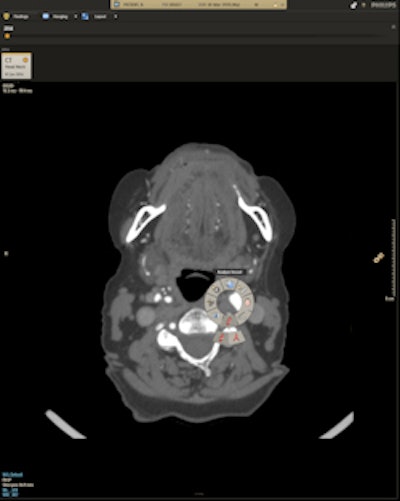 Illumeo includes tools such as an 'inspection mode' that helps users interact with images.