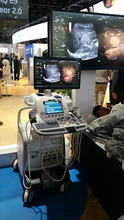 GE is highlighting new enhancements on its Logiq E9 ultrasound scanner.