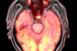 2016 11 30 14 43 58 330 Pet Mri Rsna Franceschi 400