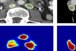 2016 11 30 17 49 23 258 Nogues Lymph Nodes 400