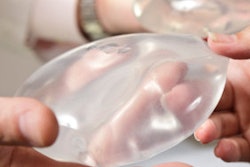 2016 12 07 14 35 08 13 Breast Implants 400