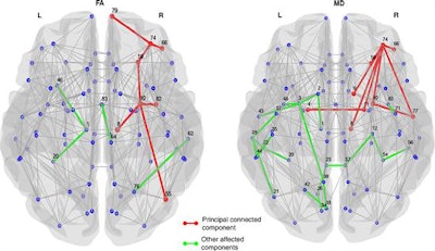 The images show affected structural connections in patients with Parkinson's disease and mild cognitive impairment relative to healthy control subjects and patients with Parkinson disease with no mild cognitive impairment. The principal connected component is shown in red, and other affected connections not included in the principal connected component are shown in green. Subnetworks show altered structural connectivity with decreased fractional anisotropy or increased mean diffusivity in patients with Parkinson's and mild cognitive impairment relative to healthy control subjects. Images courtesy of Radiology.
