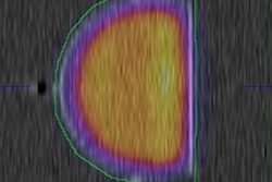2016 12 09 15 23 46 724 3 D Spect Ct Phantom 400