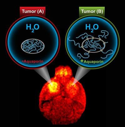DWI-MRI illustrates aquaporin's effect on tumor cells. Image courtesy of M. Shapiro Laboratory/Caltech.