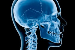 2016 11 22 14 26 41 63 Head Neck Xray 400