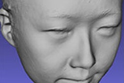 2017 01 04 14 59 43 729 2016 01 Bellus3 Dfaces 290