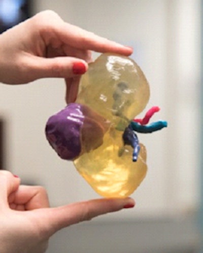 3D-printed kidney. Image courtesy of Dr. Nicole Wake.