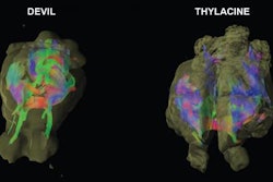2017 01 19 10 50 04 882 Tasmanian Devil 20170119175100